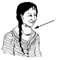 5. Utaratibu wa Kumhudumia Mama baada ya Kuzaa: View as ...