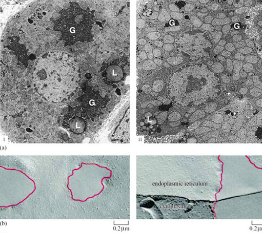 Alterations in fine structure of hibernating dormouse cells. (a) Changes in hepatocyte glycogen (G) and lipid storage deposits (L) in (i) euthermic and (ii) hibernating dormice. (b) Redistribution of membrane proteins into patches, as seen in freeze-fracture images, may enable membranes to function at lower temperatures and withstand rapid temperature changes.