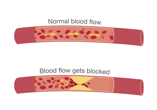 Two diagrams of arteries.