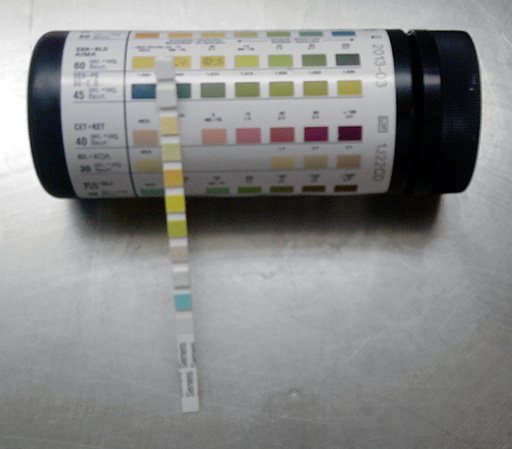 A photo of urine test strips.