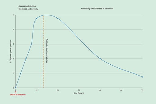 A line graph of how procalcitonin levels change in a patient with an infection.