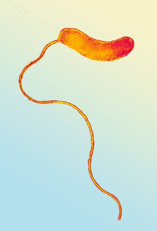 A scanning electron micrograph of the comma-shaped Bdellovibrio.