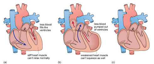 This is an illustration of three different hearts.