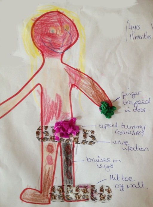 Body outline by a child mapping six pain experiences (A3 sized body outline)