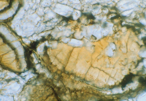 This figure is a photograph taken using an optical microscope. It shows a large globular shaped orange mineral in the centre. This is carbonate. This is surrounded by irregular rims of green and white material. White material and partial globules of orange ill the rest of the image.