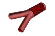 Diagram of artery