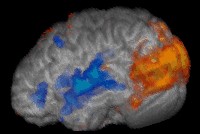 Brain image produced by FMRI [Image: FMRIB Centre]