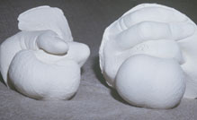 plaster casts
