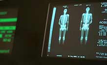 Cancer investigation x-ray
