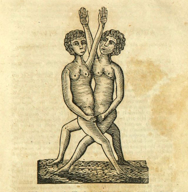 A two-headed child from the 1831 edition of Aristotle's masterpeice