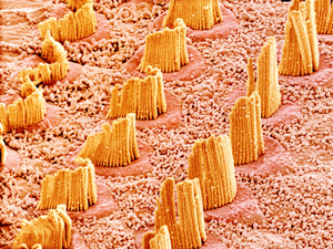 Inner ear hair cells
