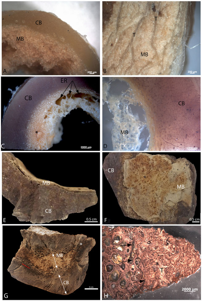 Morphological differentiation between MB and CB