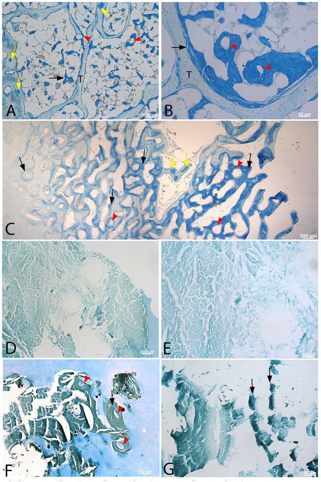 Alcian blue histochemical stain capitalizes on the differential presence of sulfated glycosaminoglycans found in MB vs CB