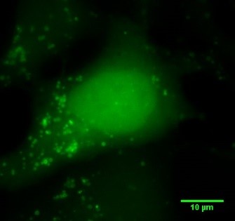 A human cell treated with a compound which induces autophagy