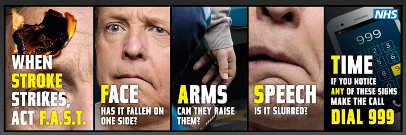 When Stroke strikes, act FAST