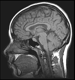 . Image of the brain obtained with MRI