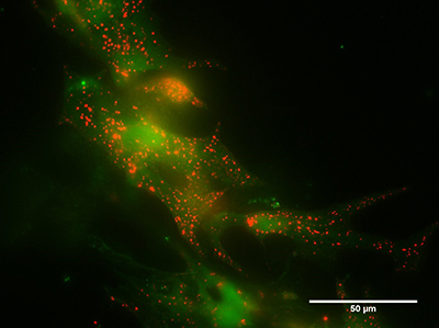 Cardiac myocytes loaded with a fluorescent stain for lysosomes (red) and a dye measuring the intracellular calcium concentration (green)