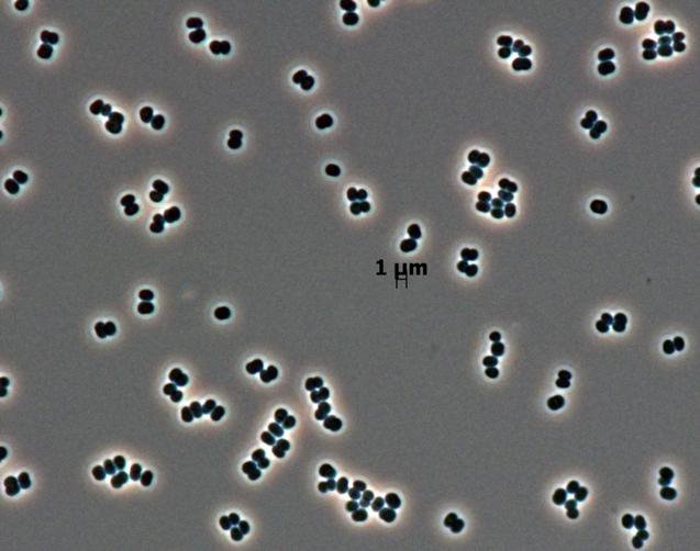 dozens of individual bacterial cells of the recently discovered species Tersicoccus phoenicis.