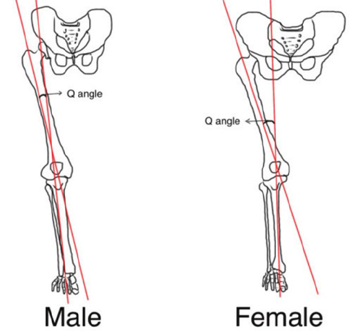 The image shows the lower limb anatomy of a male and female with a particular focus on the angle of the femur at the hip joint which is called the Q-angle. The image shows that in the female skeleton the angle between the femur and the hip is much greater than in the male skeleton.