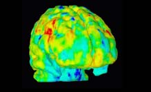 Slowdown of brain’s waste removal system could drive Alzheimer’s
