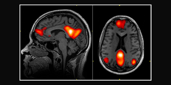 Could your brain activity be used in evidence against you?