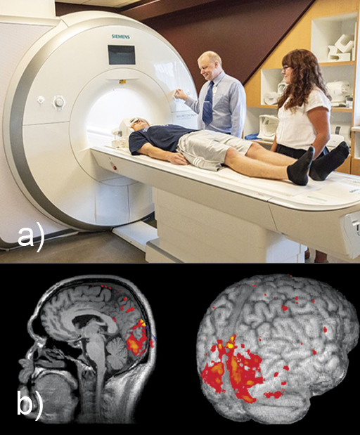 This is a composite of two images, showing an fMRI scanner and some examples of fMRI scans. Image (a) is a photograph in which a patient is about to enter a medical scanner. The patient is lying on a medical bench which is part of a large white machine with a tunnel at his head. His head is held in place by a frame. Two medical researchers are standing next to him. Image (b) shows two images taken by an fMRI scan. Both are greyscale images of brain tissue but with some regions of red and orange superimposed on top, indicating increased brain activity in these regions. The image on the left is a side view of a human brain inside a head, looking to the left. Structures in the centre of the brain are visible, including the convoluted surface of the cerebrum and cerebellum, the brain stem and corpus callosum. The skull surrounding the brain, and bones and soft tissue of the face can also be identified. The image on the right shows an external view of brain taken from the rear. Only the external features of the brain can be viewed in this image, in particular, the ridges and grooves of the cerebral cortex. In both images, there is a region at the back of the cerebrum in the occipital lobe which appears red and orange.