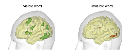 This is a diagram showing two human brains within outline heads. Regions of recorded brain activity are coloured. The left is labelled ‘Visible word’, and there are seven patches of green seen across the brain where there is brain activity. The right is labelled ‘Invisible word’, and there are two small patches of red where there is brain activity. The larger of these is located near the base of the brain at the back and the second particularly small patch is near the centre of the brain. These both have a similar shape and location although smaller size to corresponding patches in the left brain.
