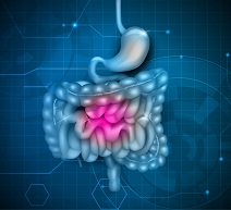 The image shows the digestive system including the stomach, small intestine and large intestine.