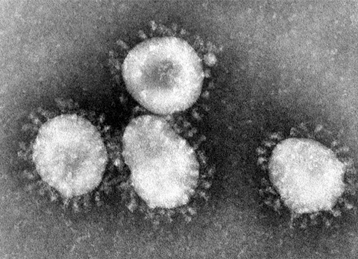 Electron micrograph image of a coronavirus.