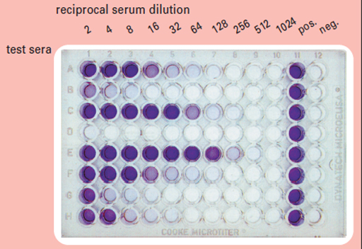 An image showing a 96-well ELISA plate at the end of an assay.