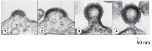 Image of transmission electron micrographs