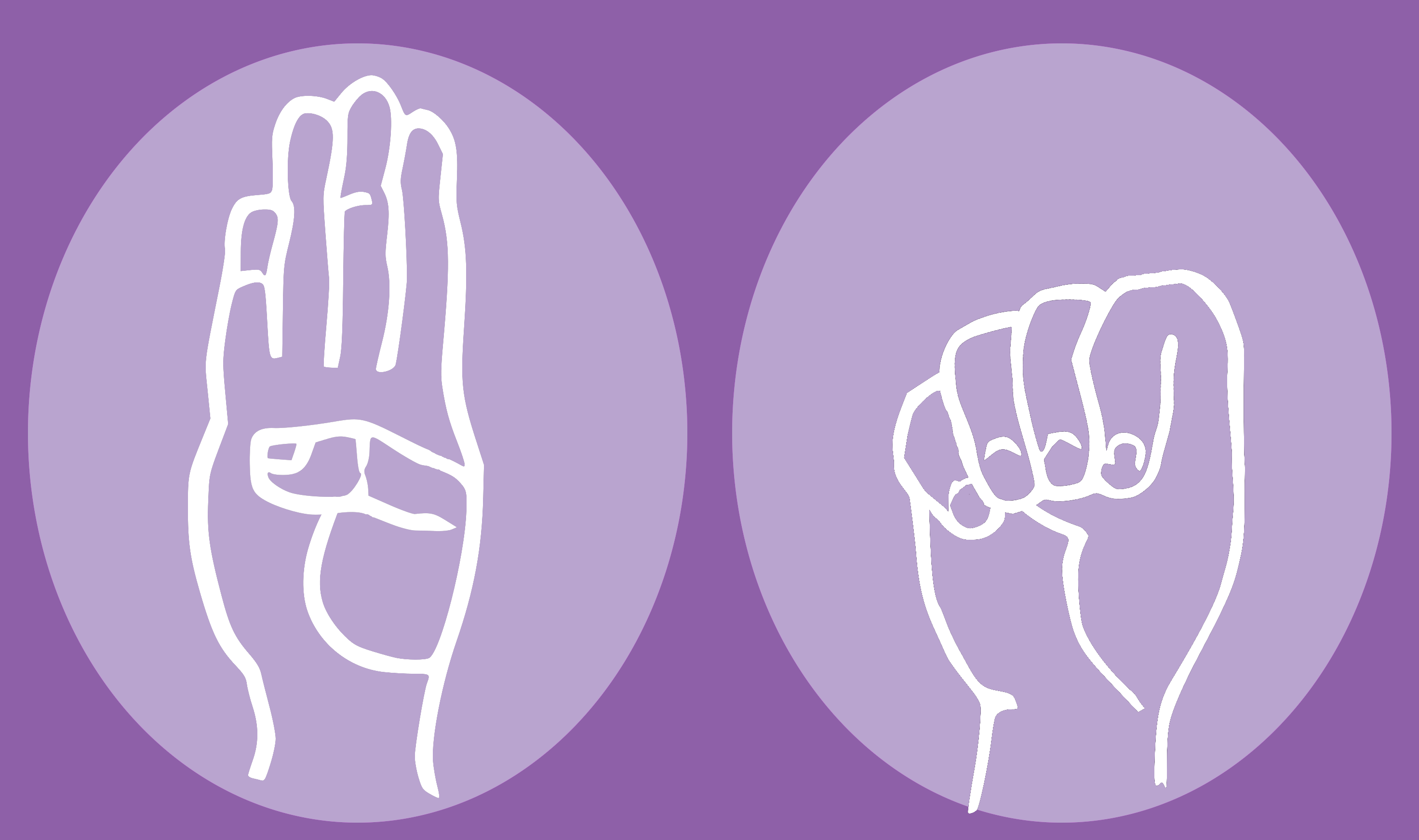 Figure composed of 2 images. Left: Palm open, facing the viewer, thumb tucked in. Right: hand is closed, thumb trapped in.