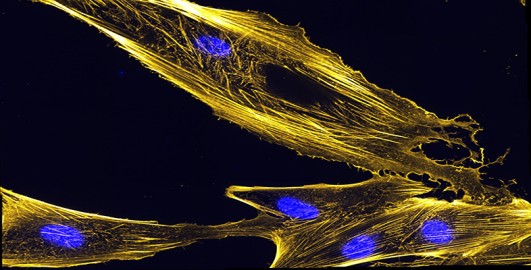 Intracellular transport