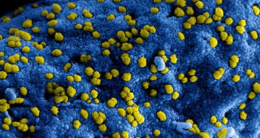 The emergence of the Middle East Respiratory Syndrome Coronavirus