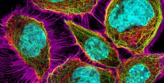 Exploring cells with digital fluorescence microscopy
