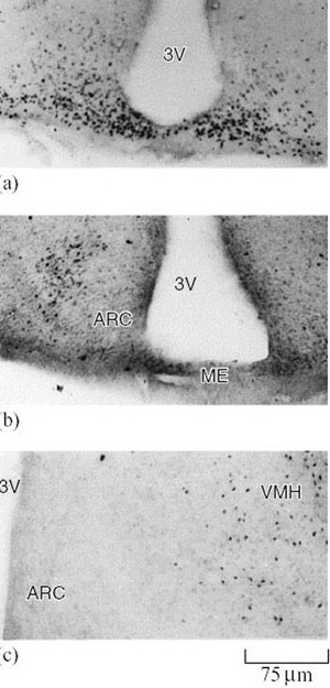 Neural adaptations found in hibernation and arousal. Photomicrographs representing the pattern of distribution of fos-immunopositive neurons in mediobasal hypothalamus of jerboas hibernating for (a) 2 days, (b) 10 days, and (c) after arousal from hibernation.