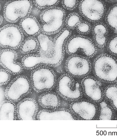 Electron microscope image of influenza virus particles.