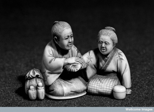 Japanese netsuke of doctor taking the pulse of his female patient.
