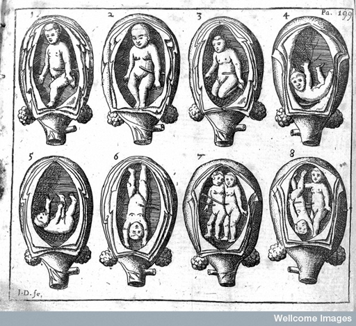 Engraved drawing of eight representations of the foetus inside the womb.