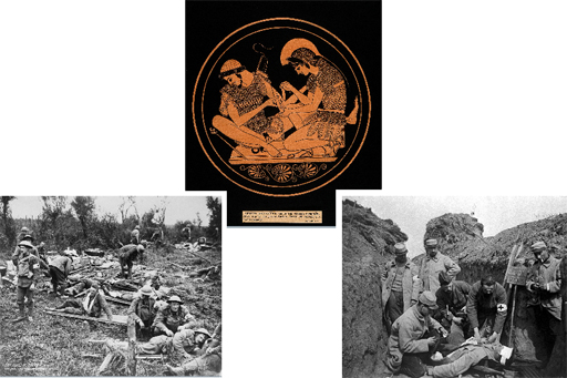 Composite image made up of three images: the decoration on an Attic cup, depicting Achilles bandaging Patroclus’ wounded arm; and two photographs of injured soldiers during World War 1.