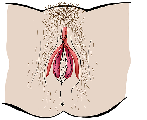 An image of female genitals, with the hidden parts of the clitoris shown in red.
