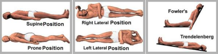 Common Patient Positions