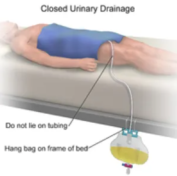 Closed Urinary Drainage