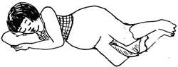 A pregnant woman sleeping with a cushion between her knees