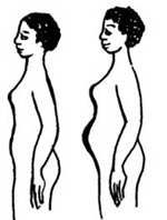 Woman with an enlarged abdomen