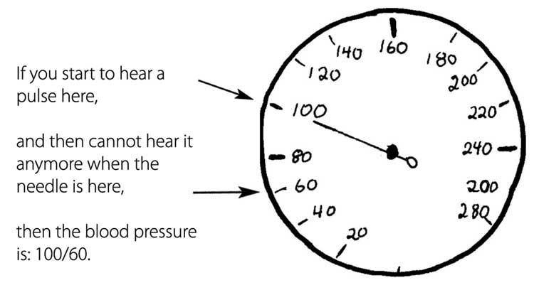 A round blood pressure gauge, pressure is indicated by a needle