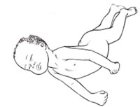 A sick child with a rigid posture.