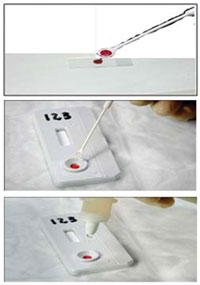 Loading the STAT-PAK device top: blood being collected from the microscope slide.