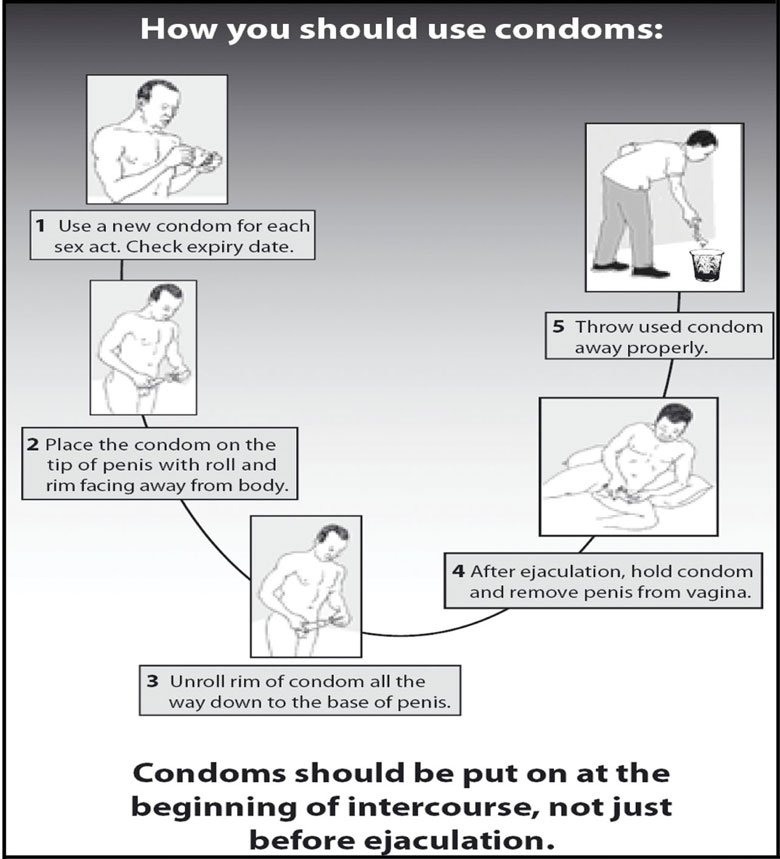 A poster showing how to use a condom correctly.