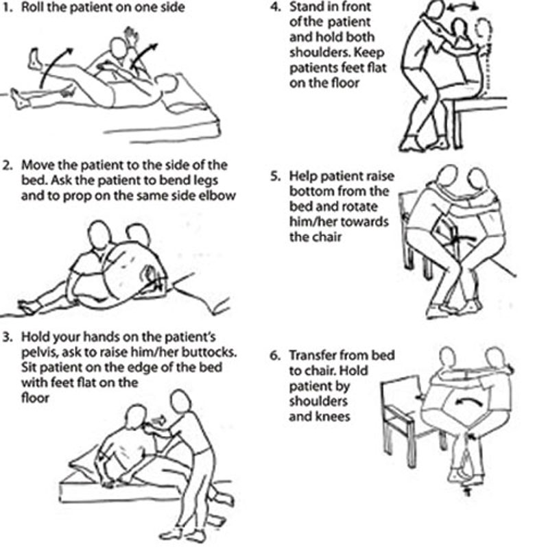 How to transfer a bedridden patient from the bed to a chair in six stages.